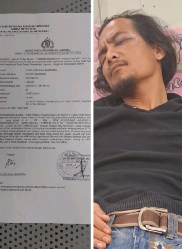 Kasus Kekerasan Terhadap Jurnalis Kembali Terjadi, Wartawan Laporkan Dugaan Tindak Pidana Pengeroyokan ke Polda Metro Jaya