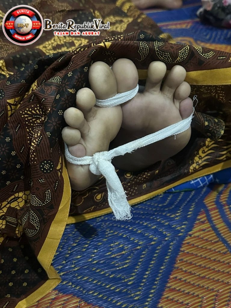 Dugaan Overdosis, Pria Berinisial CT (25) dari Langkat Meninggal Dunia Setelah Minum di Dua Tempat