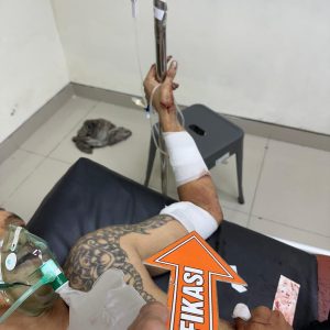 Pria di Hulaan Menganti Dibacok OTK, Polisi Buru Pelaku