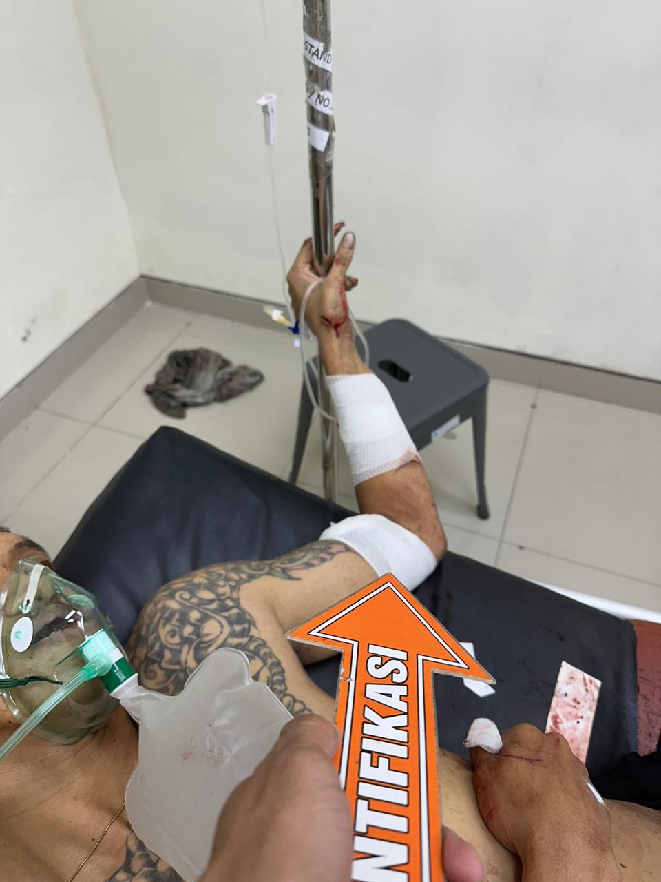 Pria di Hulaan Menganti Dibacok OTK, Polisi Buru Pelaku