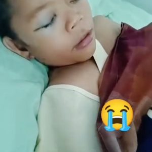 Memprihatinkan! Bocah 9 Tahun Korban Tabrak Lari Dirawat Kritis di RS Haji Medan
