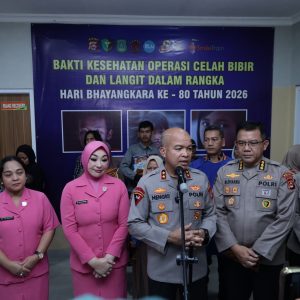 Sambut HUT Bhayangkara ke-80, Polda Banten Wujudkan Harapan 25 Anak Melalui Operasi Bibir Sumbing